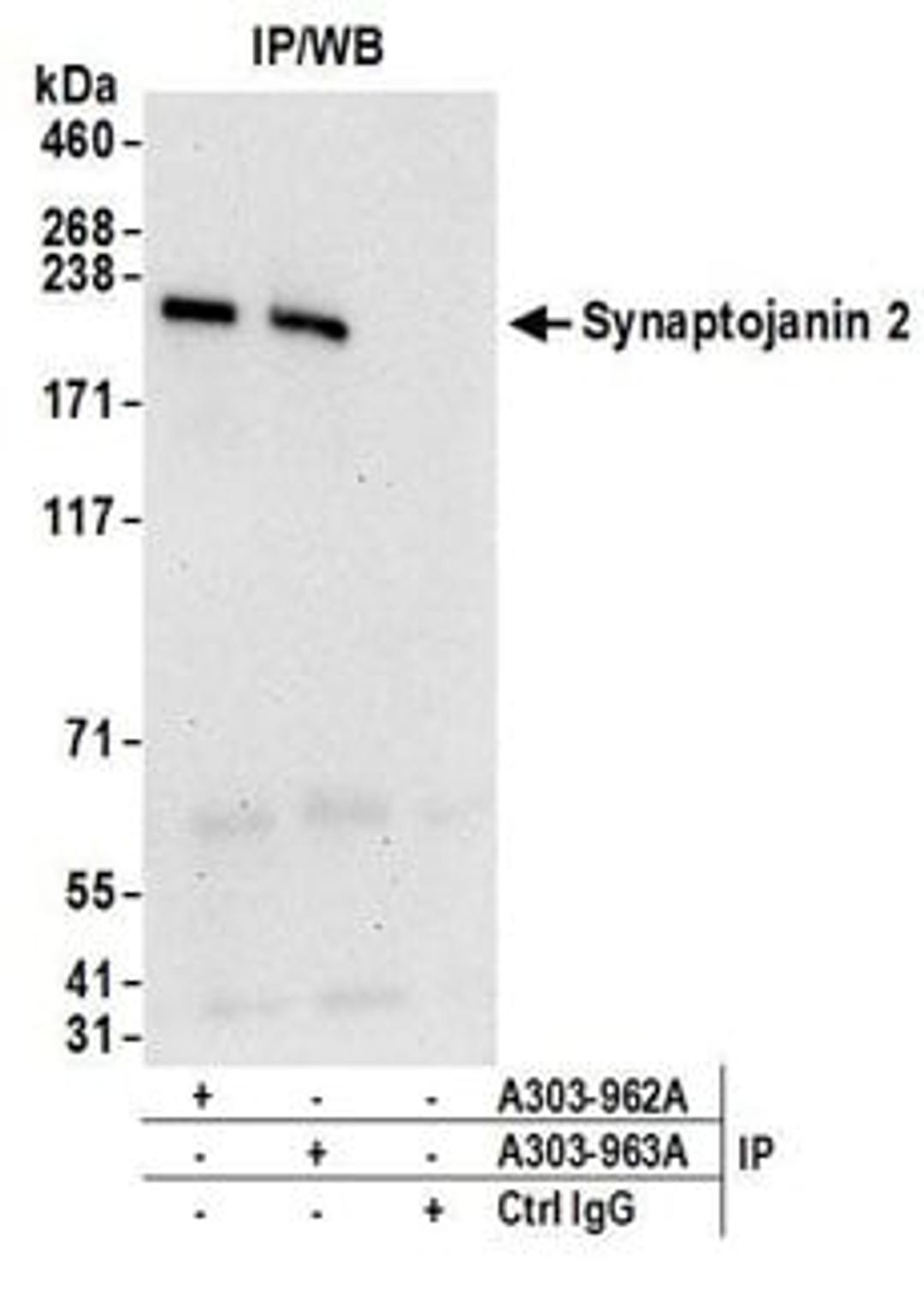 Detection of human Synaptojanin 2 by western blot of immunoprecipitates.