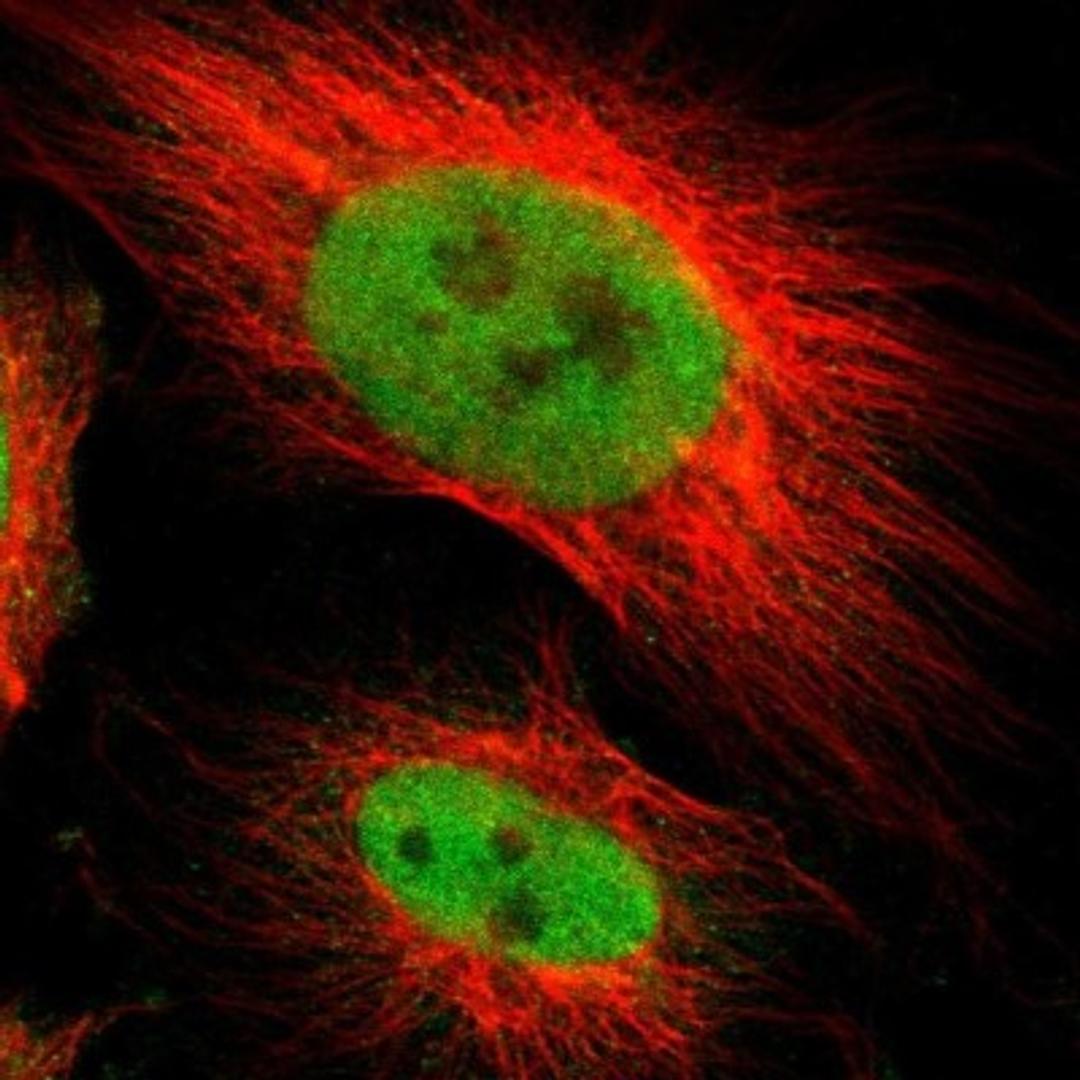 Immunofluorescence: RAR beta/NR1B2 Antibody [NBP1-81776] - Immunofluorescent staining of human cell line U-251MG shows positivity in nucleus but not nucleoli.