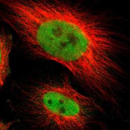 Immunofluorescence: RAR beta/NR1B2 Antibody [NBP1-81776] - Immunofluorescent staining of human cell line U-251MG shows positivity in nucleus but not nucleoli.