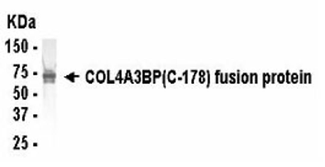 Western Blot: E coli-derived fusion protein as test antigen. XW-7119 dilution: 1:2,000.