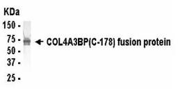 Western Blot: E coli-derived fusion protein as test antigen. XW-7119 dilution: 1:2,000.