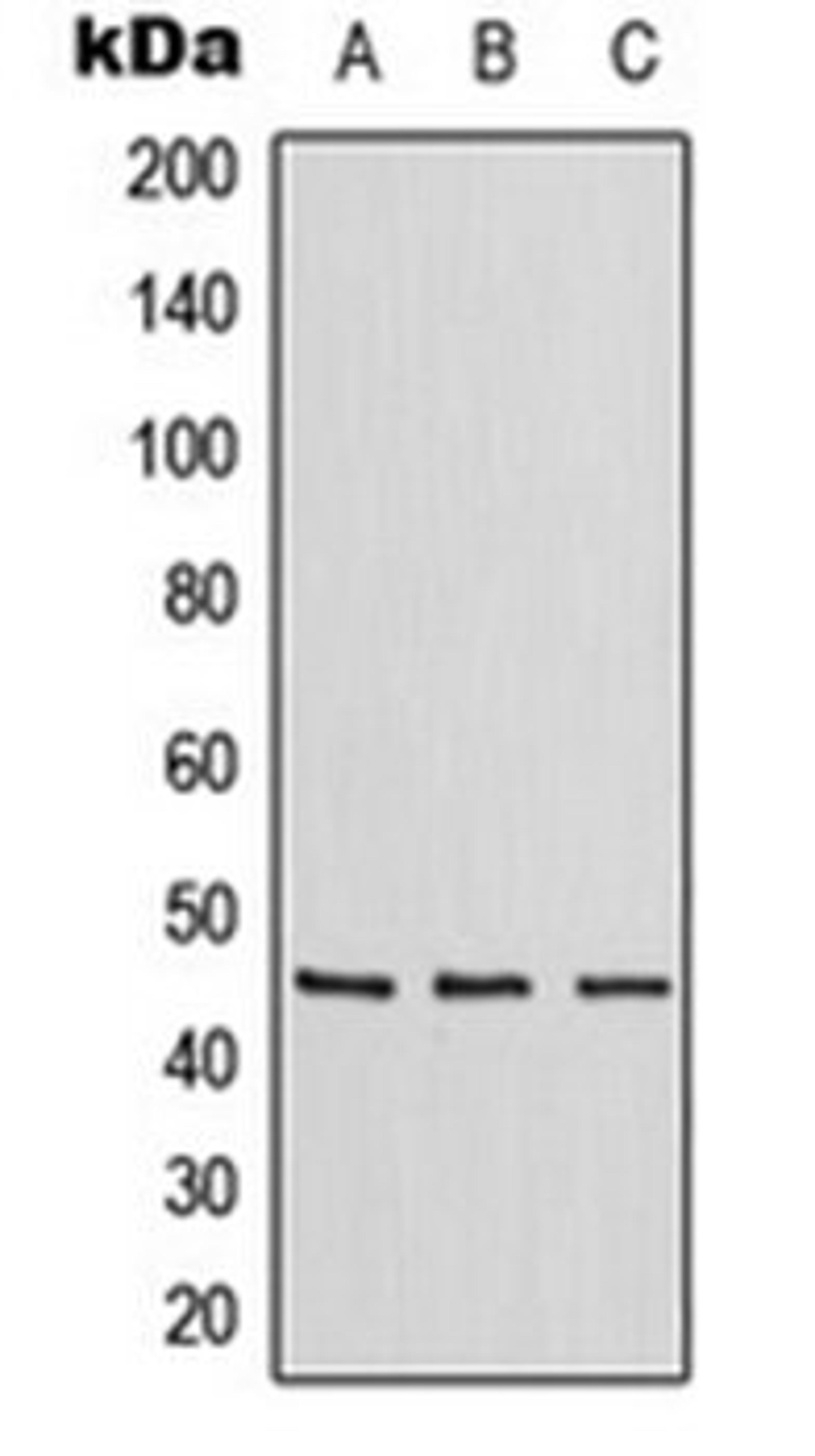 Western blot analysis of Jurkat (Lane 1), Raw264.7 (Lane 2), H9C2 (Lane 3) whole cell lysates using ZNF174 antibody