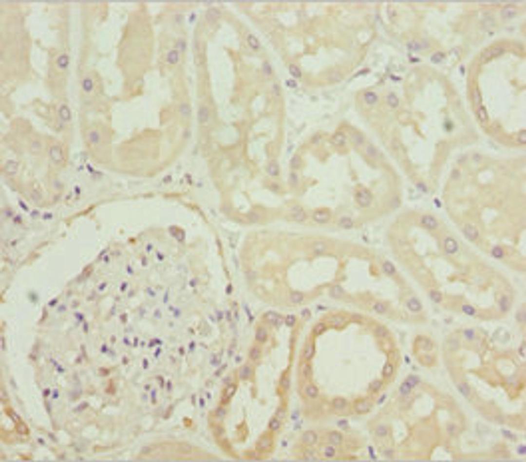 Immunohistochemistry of paraffin-embedded human kidney tissue using CSB-PA866264ESR1HU at dilution of 1:100