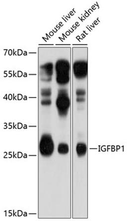 Western blot - IGFBP1 antibody (A11109)