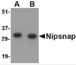 Western blot analysis of NIPSNAP in human brain tissue lysate with NIPSNAP antibody at (A) 0.5 and (B) 1 &#956;g/mL.