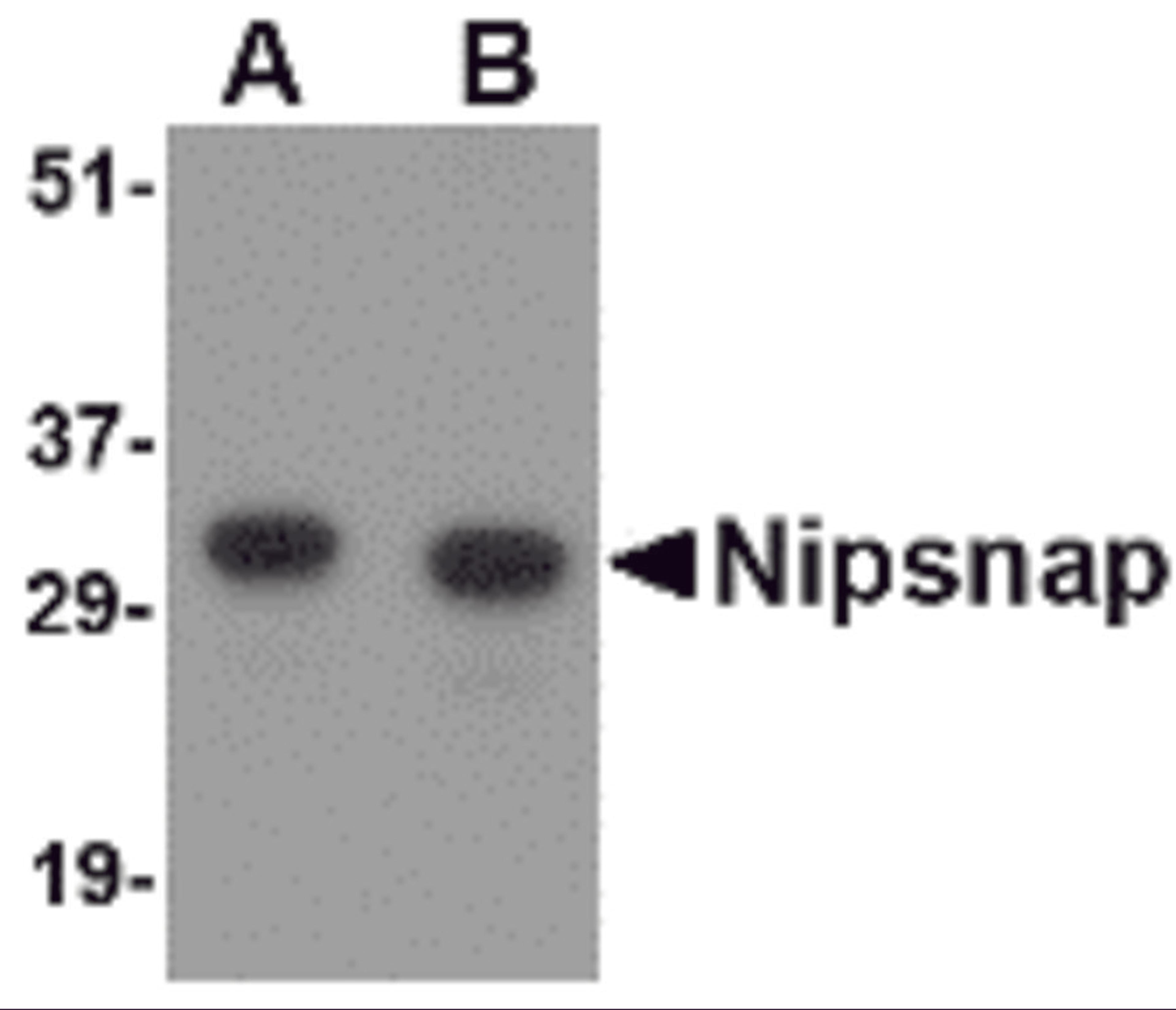 Western blot analysis of NIPSNAP in human brain tissue lysate with NIPSNAP antibody at (A) 0.5 and (B) 1 &#956;g/mL.