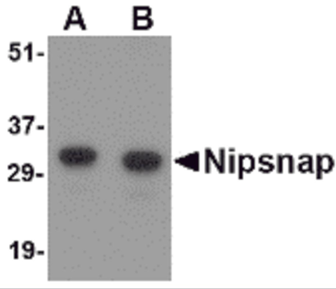 Western blot analysis of NIPSNAP in human brain tissue lysate with NIPSNAP antibody at (A) 0.5 and (B) 1 μg/mL.