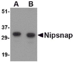 Western blot analysis of NIPSNAP in human brain tissue lysate with NIPSNAP antibody at (A) 0.5 and (B) 1 μg/mL.