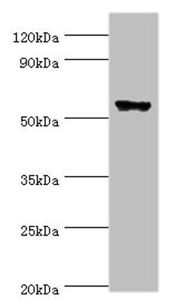 Western blot. All lanes: CLK2 antibody at 5ug/ml + Hela whole cell lysate. Secondary. Goat polyclonal to rabbit IgG at 1/10000 dilution. Predicted band size: 61, 18, 60 kDa. Observed band size: 61 kDa.