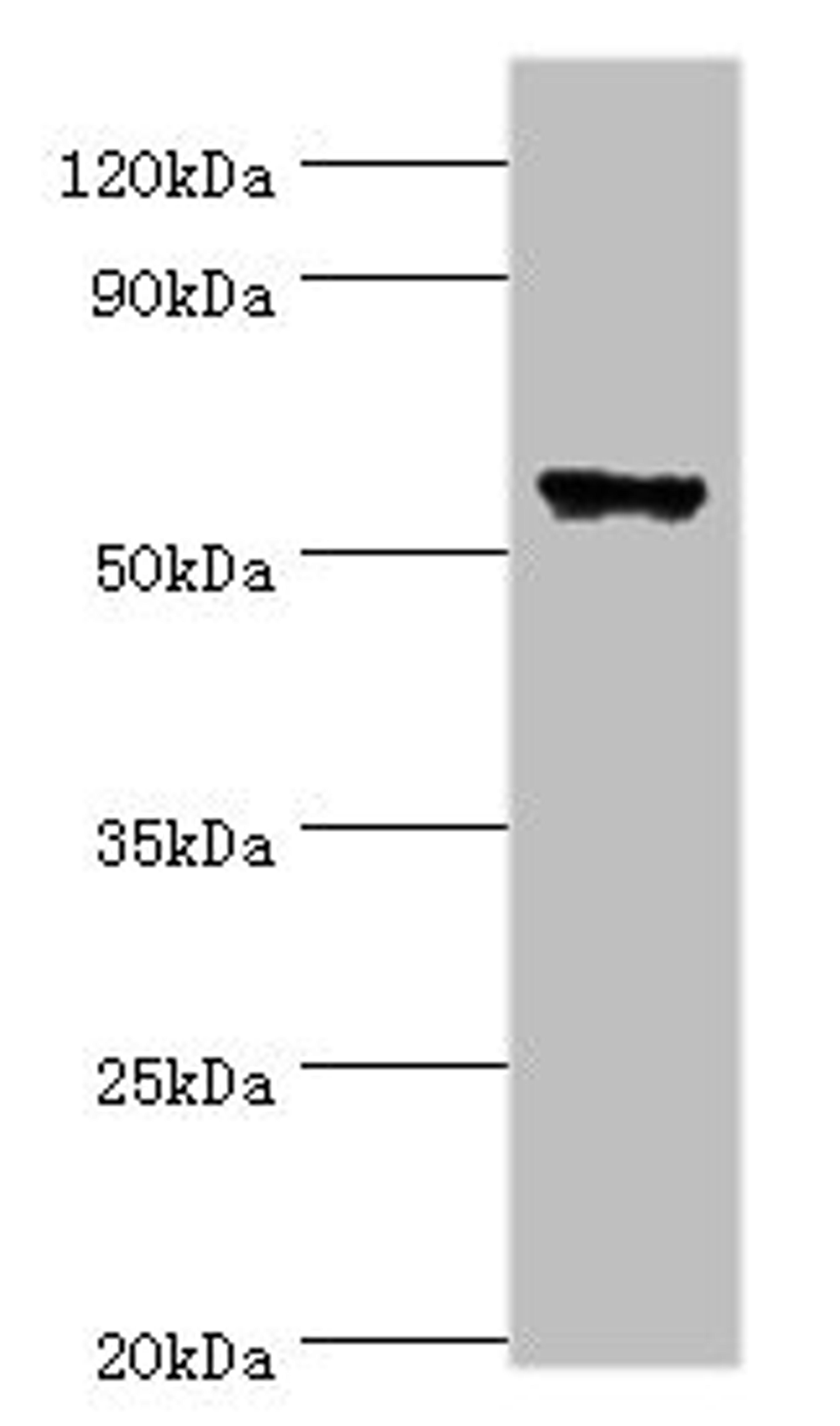 Western blot. All lanes: CLK2 antibody at 5ug/ml + Hela whole cell lysate. Secondary. Goat polyclonal to rabbit IgG at 1/10000 dilution. Predicted band size: 61, 18, 60 kDa. Observed band size: 61 kDa.