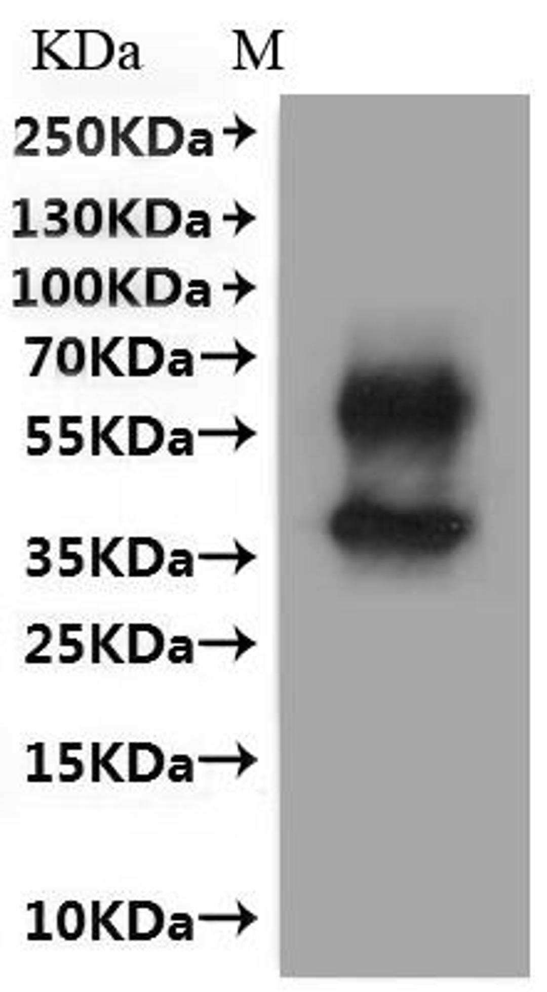 CSB-MP015007MO is detected by Mouse anti-6*His monoclonal antibody.