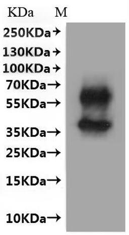 CSB-MP015007MO is detected by Mouse anti-6*His monoclonal antibody.