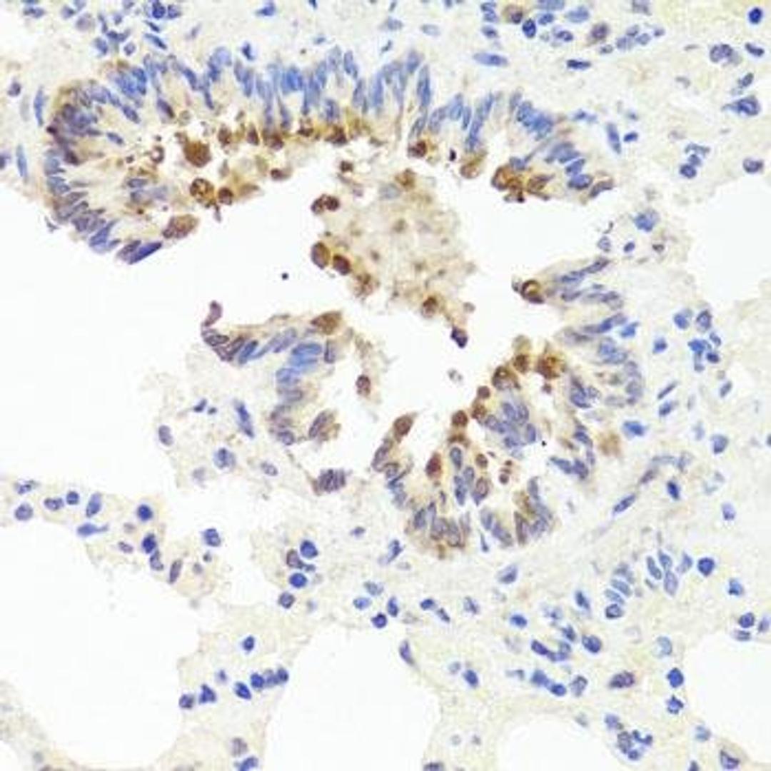 Immunohistochemical staining of mouse stomach tissue using AMBRA1 antibody (dilution of 1:100)