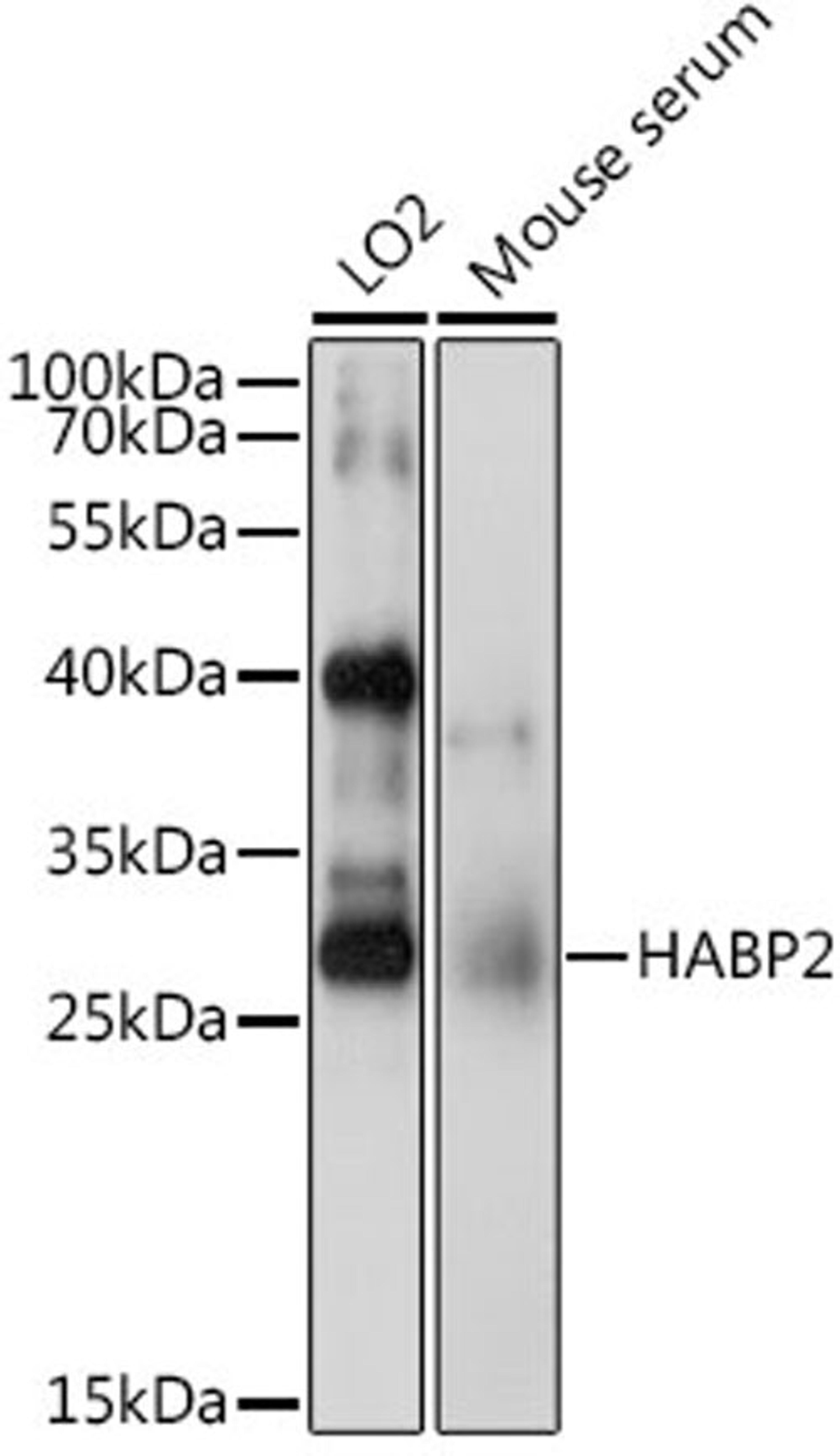 Western blot - HABP2 antibody (A6919)