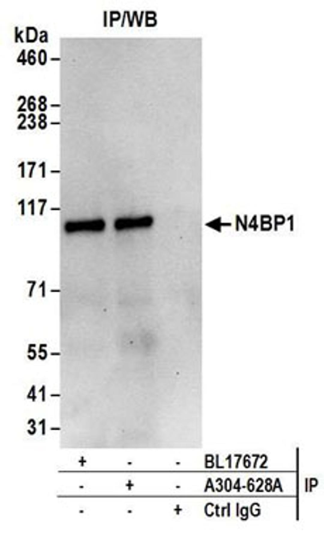 Detection of human N4BP1 by western blot of immunoprecipitates.