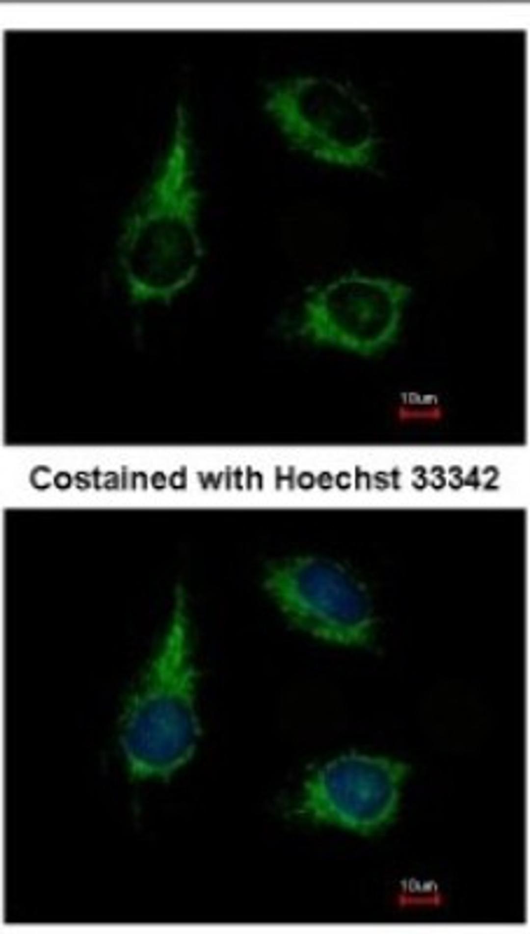 Immunocytochemistry/Immunofluorescence: ENOSF1 Antibody [NBP2-16338] - Immunofluorescence analysis of methanol-fixed HeLa, using antibody at 1:500 dilution.