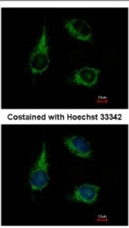 Immunocytochemistry/Immunofluorescence: ENOSF1 Antibody [NBP2-16338] - Immunofluorescence analysis of methanol-fixed HeLa, using antibody at 1:500 dilution.