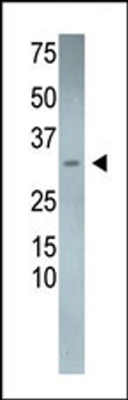 Antibody is used in Western blot to detect DSCR1L2 in mouse heart tissue lysate.