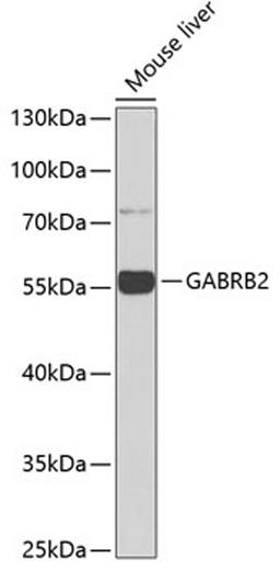 Western blot - GABRB2 antibody (A1876)