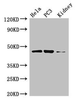 Western Blot. Positive WB detected in: Hela whole cell lysate, PC-3 whole cell lysate, Mouse kidney tissue. All lanes: GSK3B antibody at 3µg/ml. Secondary. Goat polyclonal to rabbit IgG at 1/50000 dilution. Predicted band size: 47, 49 kDa. Observed band size: 47 kDa