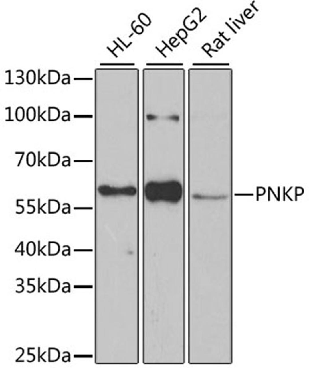 Western blot - PNKP antibody (A6693)