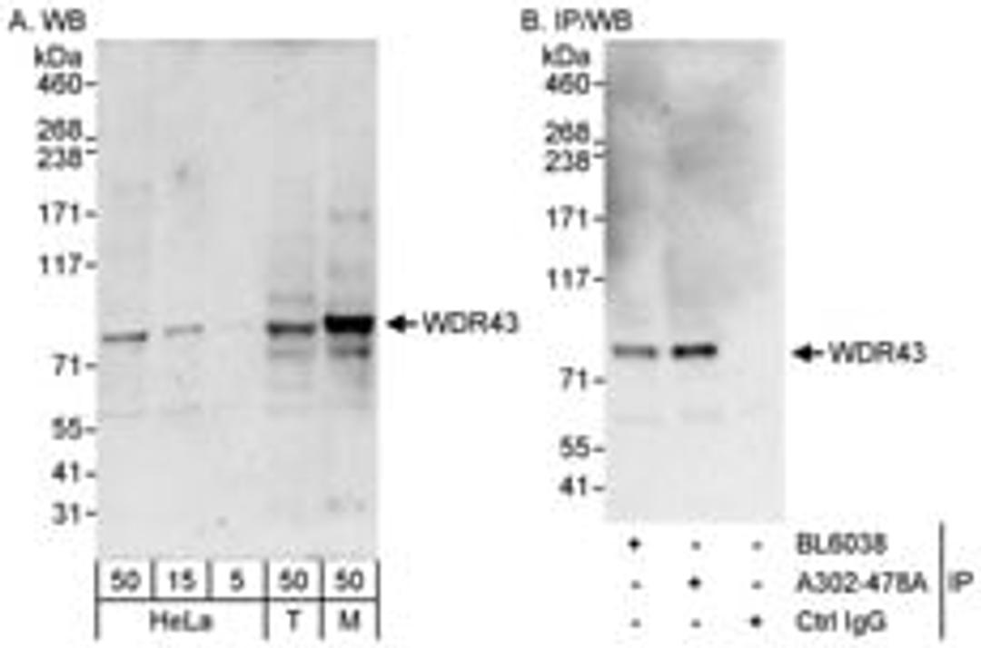 Detection of human and mouse WDR43 by western blot (h&m) and immunoprecipitation (h).