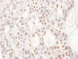 Detection of human CDKL5 by immunohistochemistry.