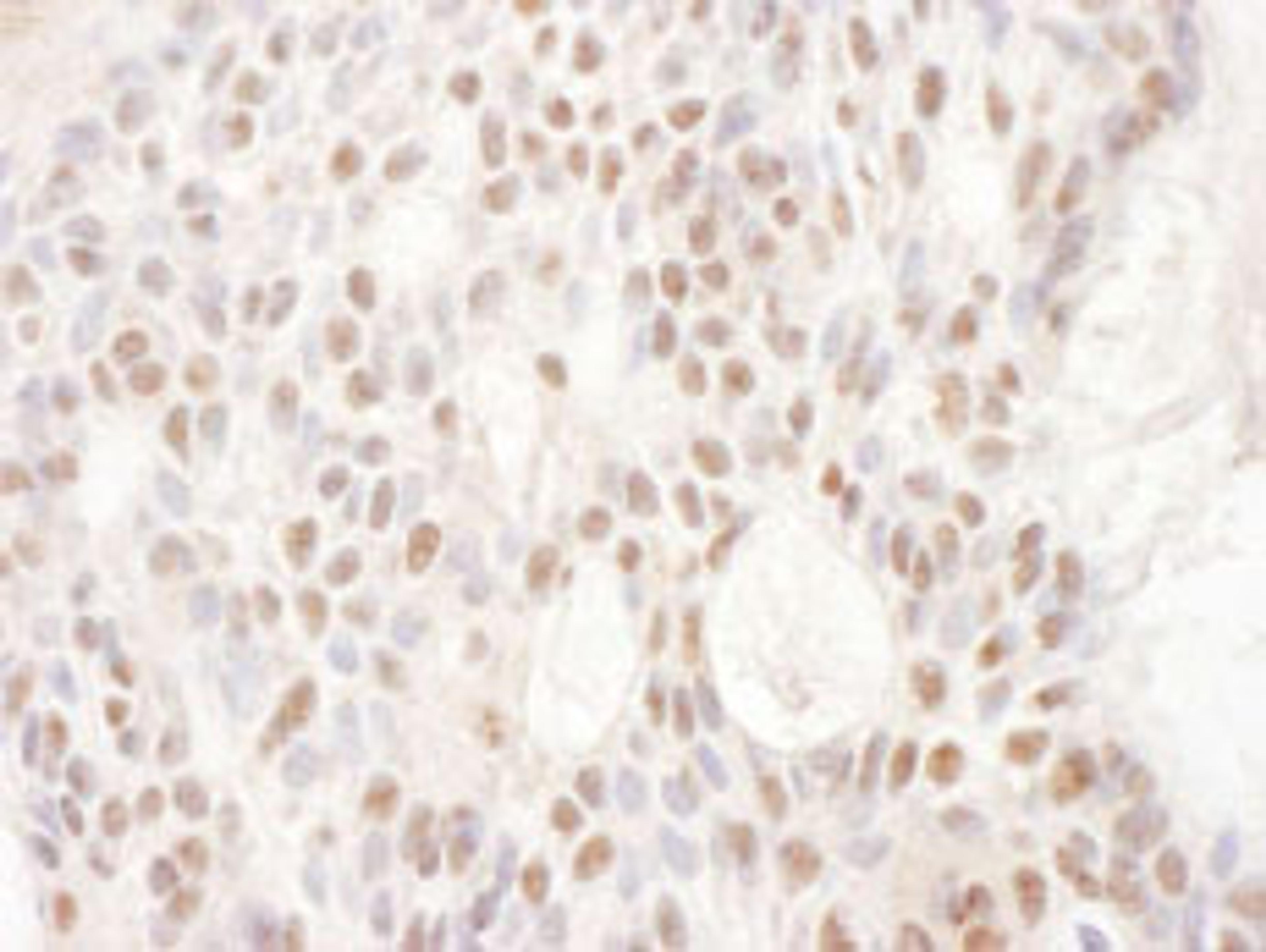 Detection of human CDKL5 by immunohistochemistry.