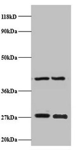 Western blot. All lanes: NDUFV2 antibody at 2µg/ml. Lane 1: EC109 whole cell lysate. Lane 2: 293T whole cell lysate. Secondary. Goat polyclonal to rabbit IgG at 1/15000 dilution. Predicted band size: 28 kDa. Observed band size: 28 kDa