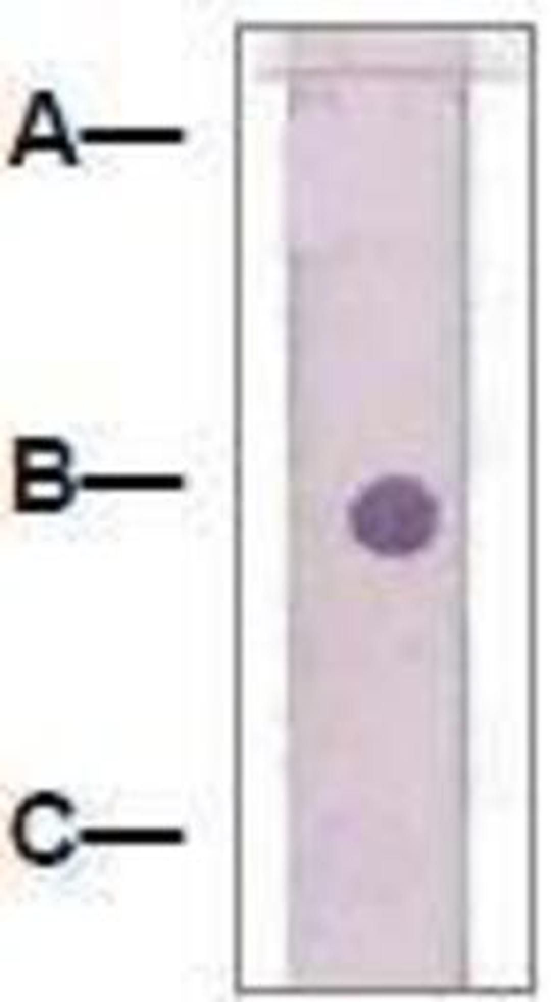 Dot Blot: beta Catenin Antibody [NBP1-73993] - 1 mg peptide was blot onto NC membrane: A: Non-Related phosphopeptde / B: Beta-Catenin (pY280) / C: Beta-Catenin (Non-Phospho).  Followed by immunoblotting Rabbit anti-beta-Catenin (pY280) at 1:1000.