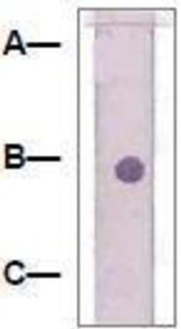 Dot Blot: beta Catenin Antibody [NBP1-73993] - 1 mg peptide was blot onto NC membrane: A: Non-Related phosphopeptde / B: Beta-Catenin (pY280) / C: Beta-Catenin (Non-Phospho).  Followed by immunoblotting Rabbit anti-beta-Catenin (pY280) at 1:1000.