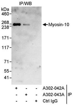 Detection of human Myosin-10 by western blot of immunoprecipitates.