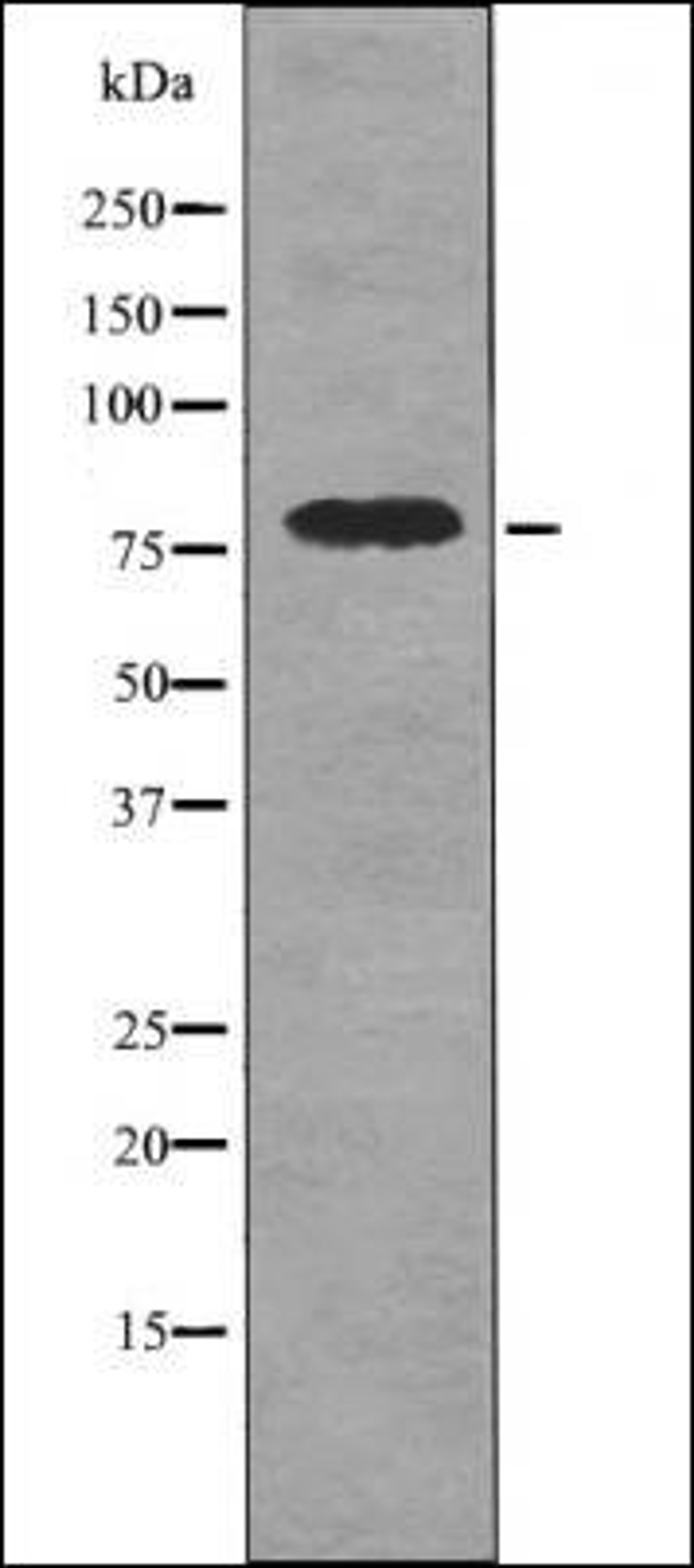 Western blot analysis of UV treated 293 whole cell lysates using DRP1 -Phospho-Ser616- antibody