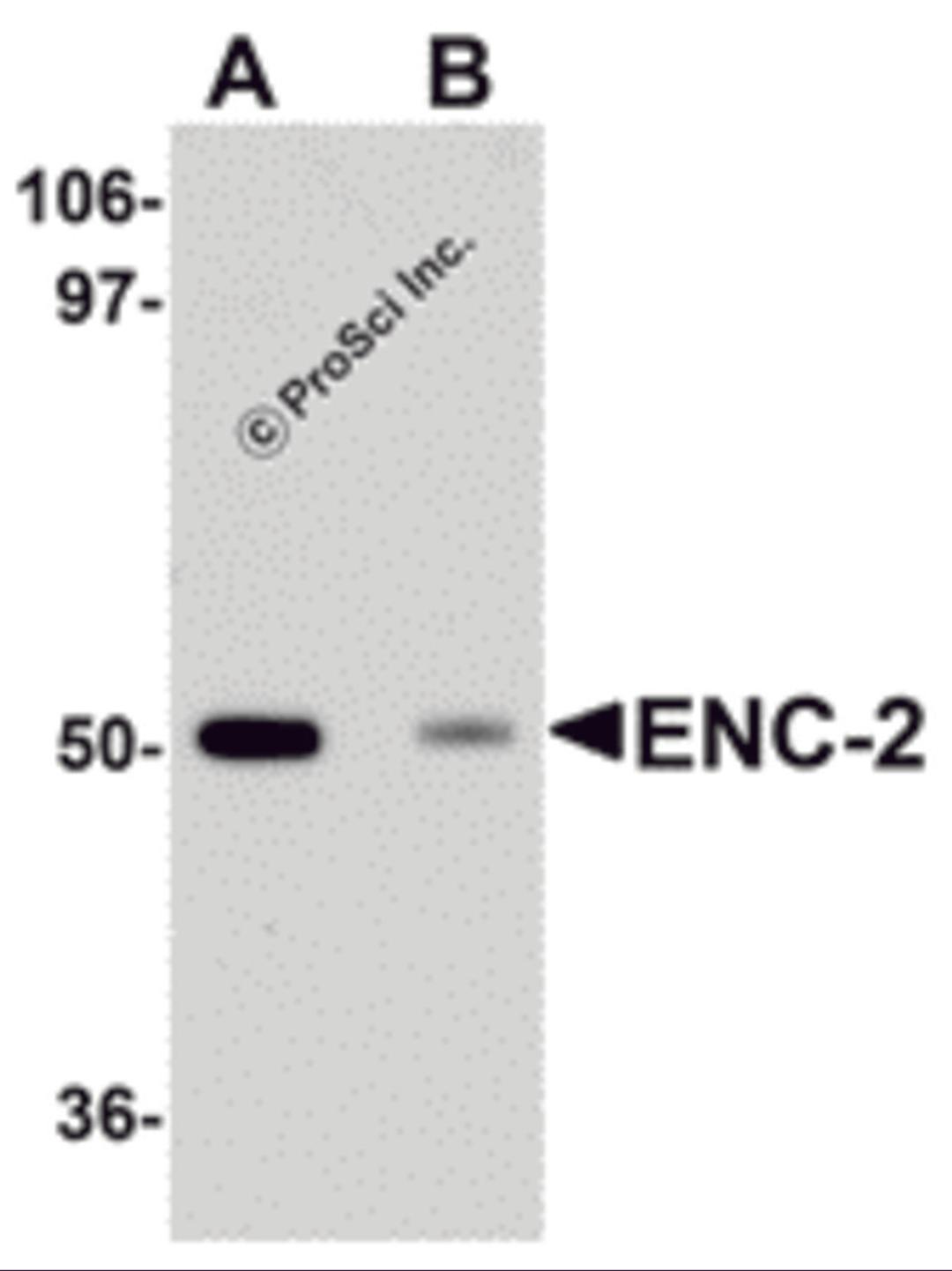 Western blot analysis of ENC-2 in Jurkat cell lysate with ENC-2 antibody at 1 μg/mL in (A) the absence and (B) the presence of blocking peptide.