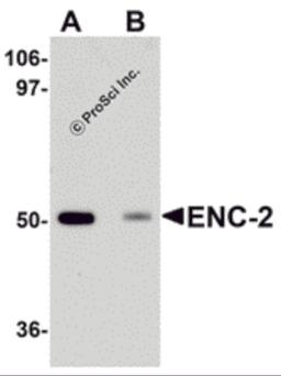 Western blot analysis of ENC-2 in Jurkat cell lysate with ENC-2 antibody at 1 μg/mL in (A) the absence and (B) the presence of blocking peptide.
