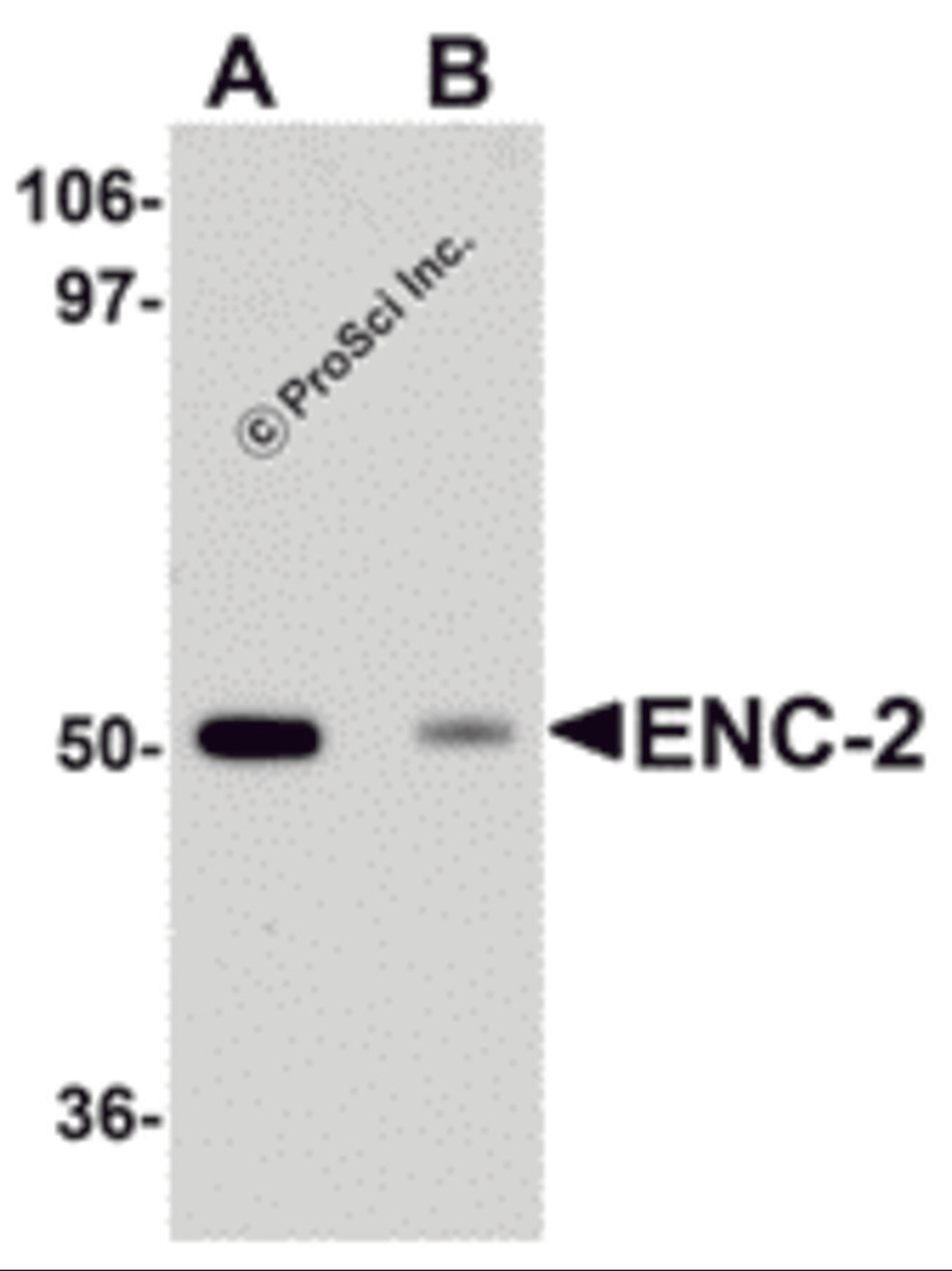 Western blot analysis of ENC-2 in Jurkat cell lysate with ENC-2 antibody at 1 μg/mL in (A) the absence and (B) the presence of blocking peptide.
