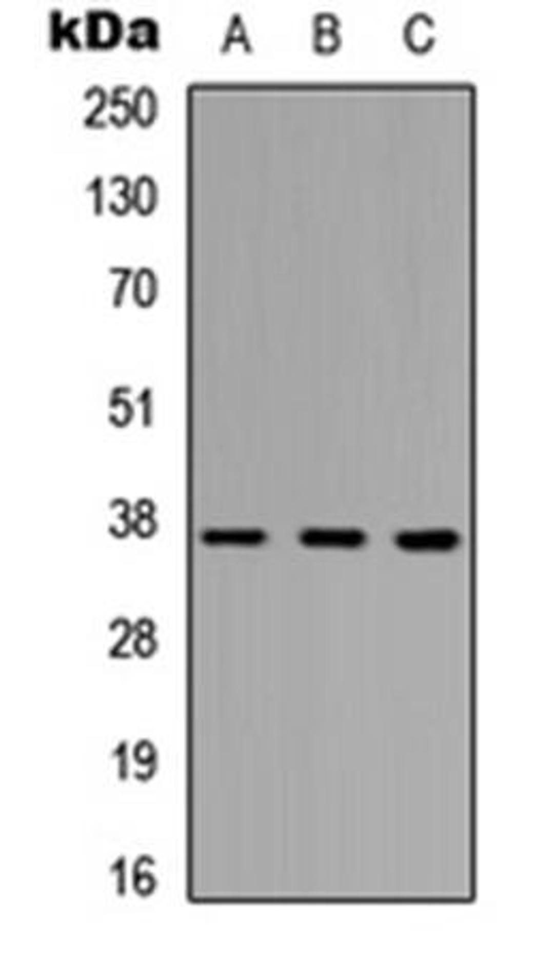 Western blot analysis of HEK293T (Lane1), Raw264.7 (Lane2), H9C2 (Lane3) whole cell using PINX1 antibody