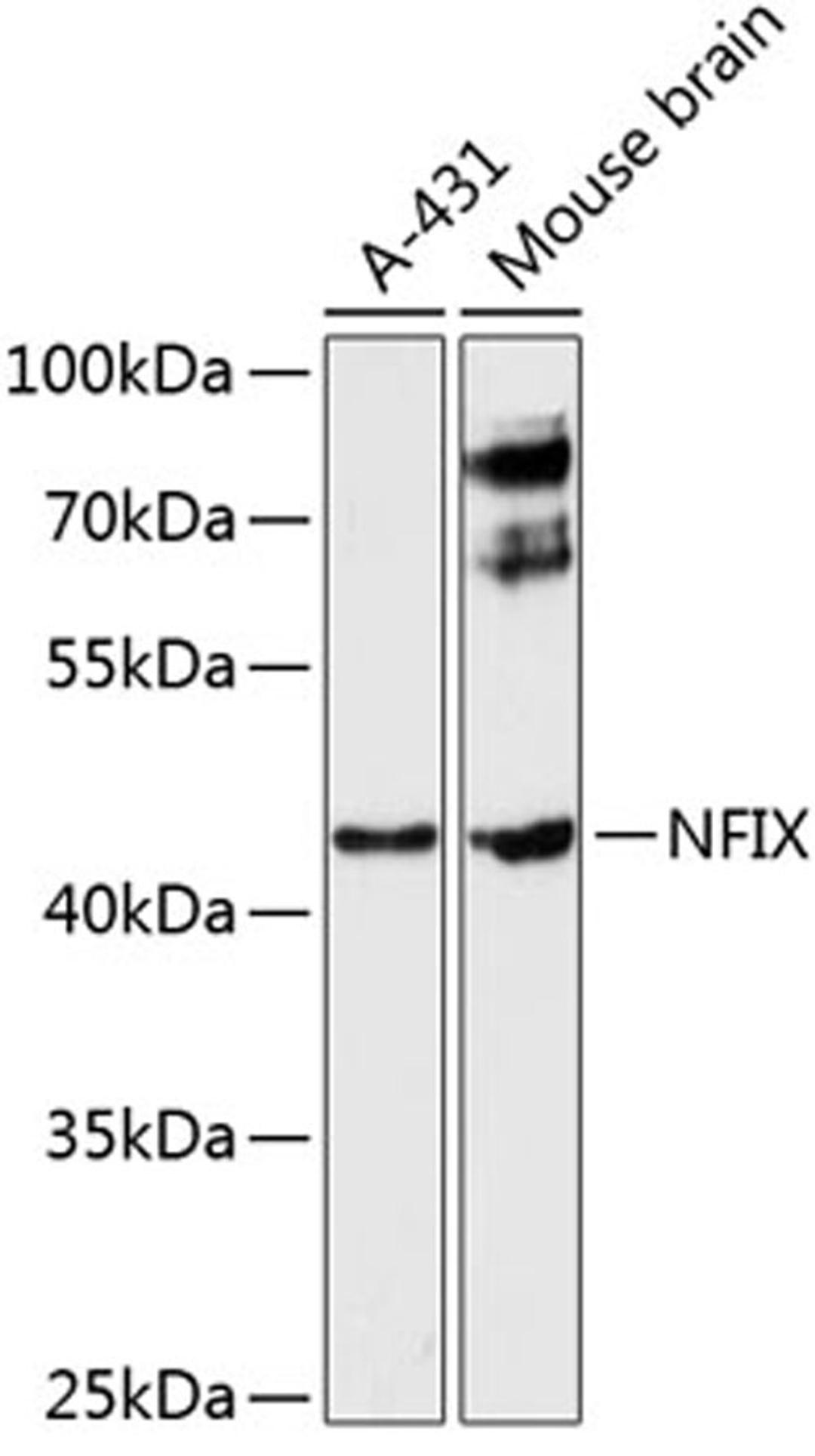 Western blot - NFIX antibody (A9390)