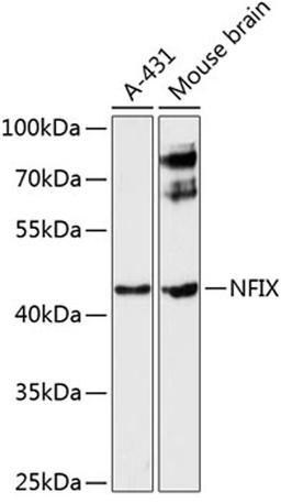 Western blot - NFIX antibody (A9390)