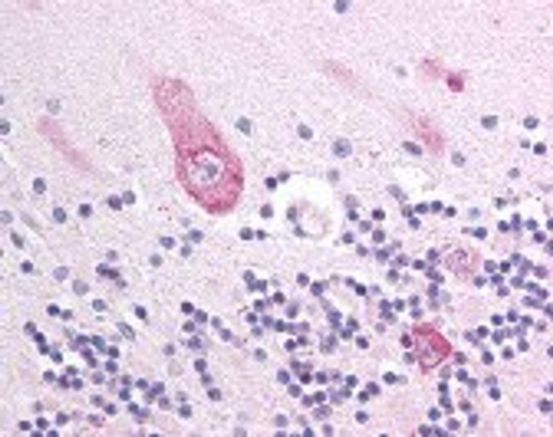 Immunohistochemistry staining of MLL5 in cerebellum tissue using MLL5 Antibody.