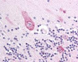 Immunohistochemistry staining of MLL5 in cerebellum tissue using MLL5 Antibody.