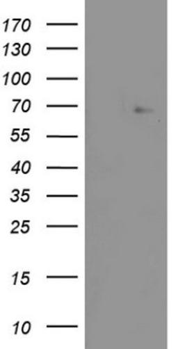 Western Blot: ZNF286 Antibody (7D2) [NBP2-46432] - Analysis of HEK293T cells were transfected with the pCMV6-ENTRY control (Left lane) or pCMV6-ENTRY ZNF286A.