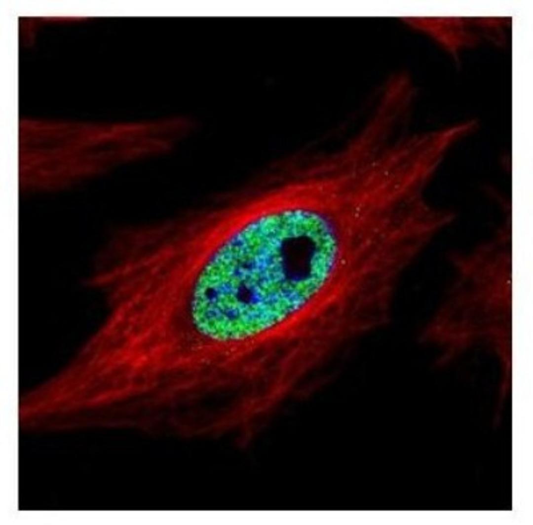 Immunocytochemistry/Immunofluorescence: SMARCC1 Antibody [NBP2-20415] - Confocal immunofluorescence analysis of paraformaldehyde-fixed HeLa, using SMARCC1 antibody (Green) at 1:500 dilution. Alpha-tubulin filaments are labeled with Alpha-tubulin antibody (Red) at 1:2000.