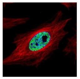 Immunocytochemistry/Immunofluorescence: SMARCC1 Antibody [NBP2-20415] - Confocal immunofluorescence analysis of paraformaldehyde-fixed HeLa, using SMARCC1 antibody (Green) at 1:500 dilution. Alpha-tubulin filaments are labeled with Alpha-tubulin antibody (Red) at 1:2000.