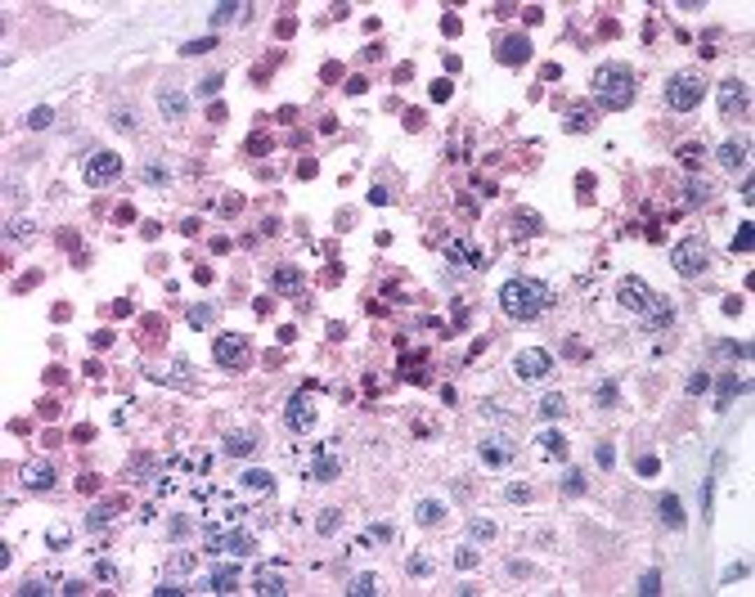 Immunohistochemistry staining of MAGEB3 in testis (formalin-fixed paraffin embedded) tissue using MAGEB3 Antibody.