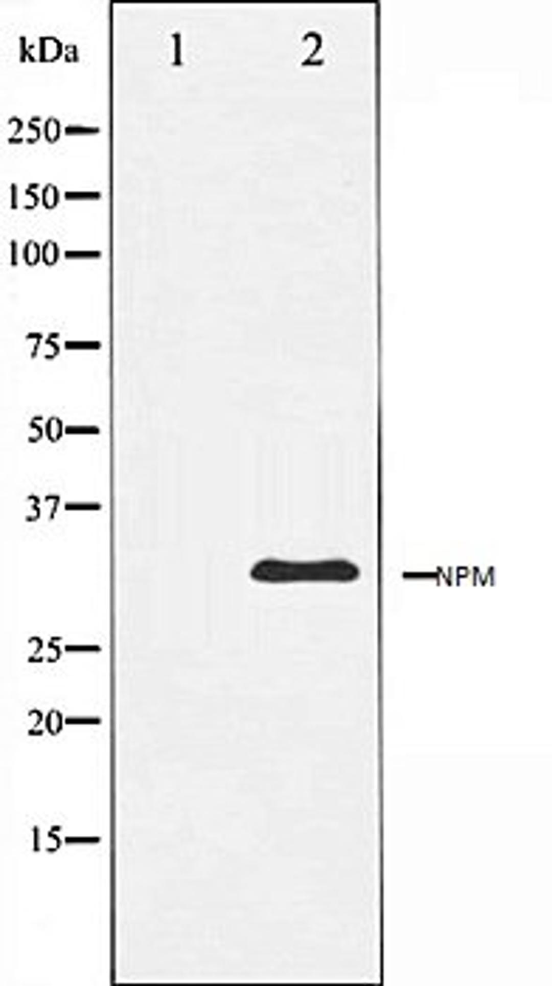 Western blot analysis of Jurkat whole cell lysates using NPM antibody, The lane on the left is treated with the antigen-specific peptide.