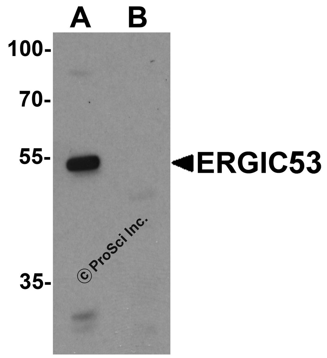 Western blot analysis of ERGIC53 in HL60 cell lysate with ERGIC53 antibody at 1 μg/mL in (A) the absence and (B) the presence of blocking buffer.