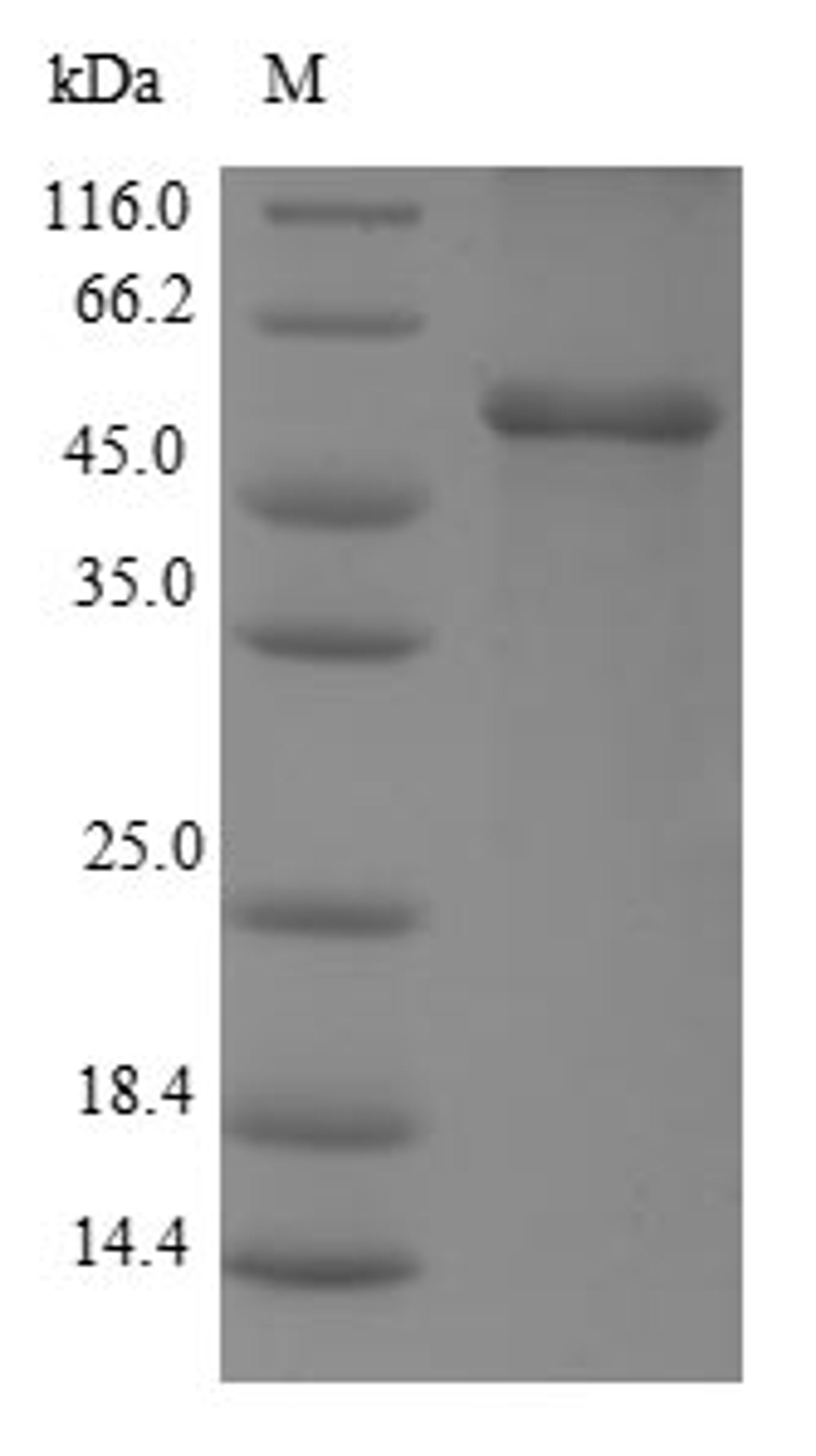 (Tris-Glycine gel) Discontinuous SDS-PAGE (reduced) with 5% enrichment gel and 15% separation gel.