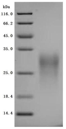 (Tris-Glycine gel) Discontinuous SDS-PAGE (reduced) with 5% enrichment gel and 15% separation gel.