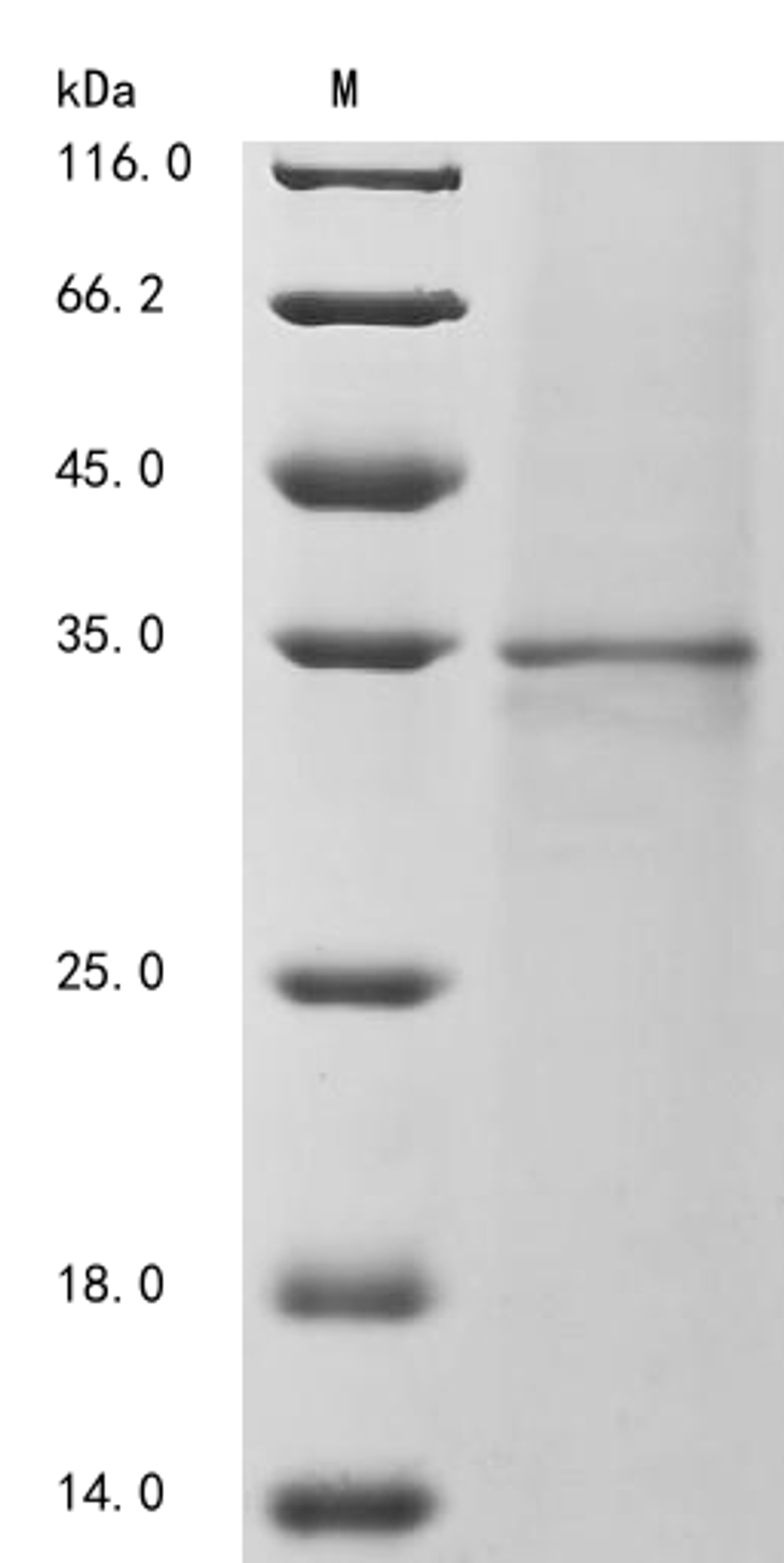 (Tris-Glycine gel) Discontinuous SDS-PAGE (reduced) with 5% enrichment gel and 15% separation gel.